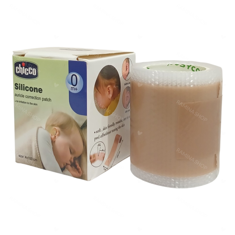 چسب اصلاح فرم گوش نوزاد چیکو Chicoo